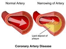 February is Heart Month!