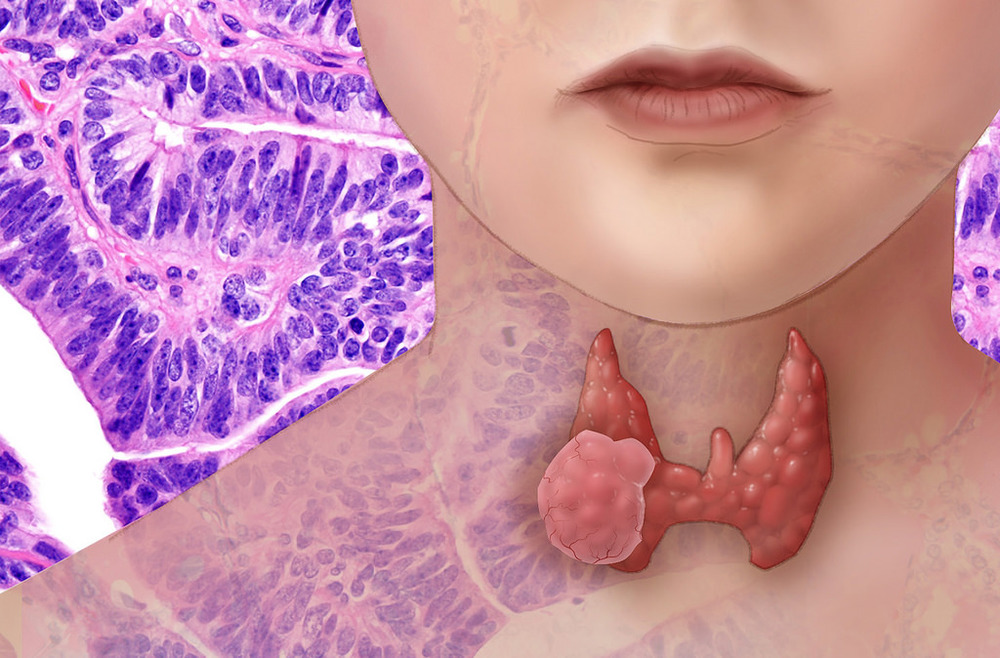 Is Your Thyroid Healthy?